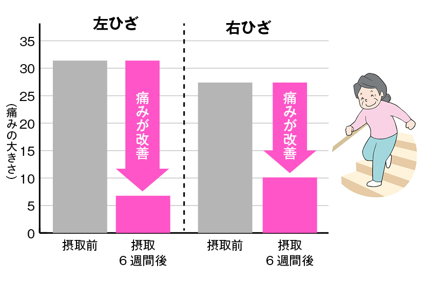 階段を登り降りする時のひざの痛み
