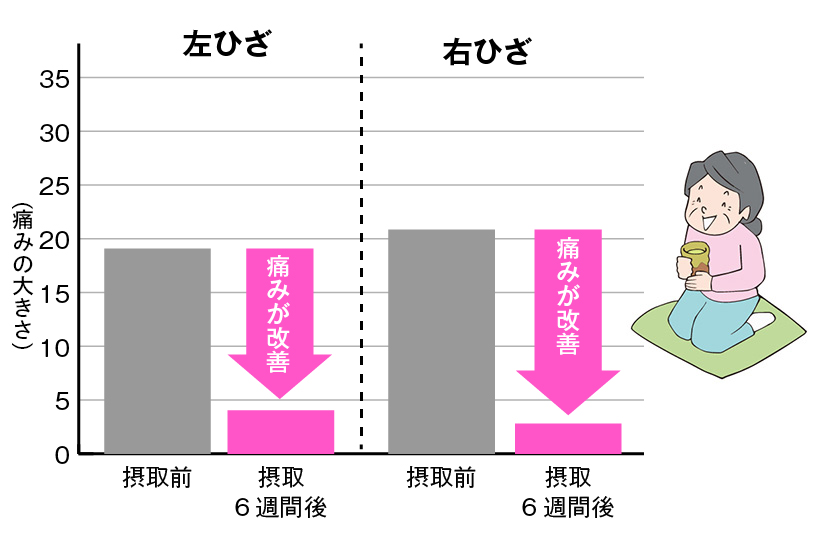 運動していない時のひざの痛み