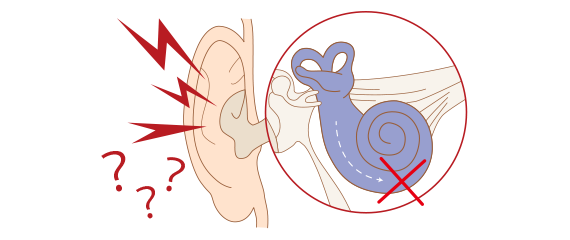 耳鳴り原因と対策 健康情報サイト 元気web