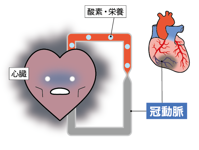 心不全