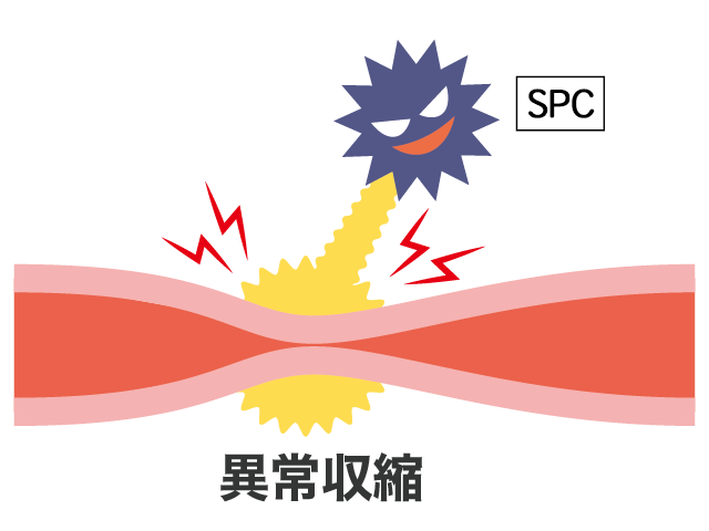 SPC